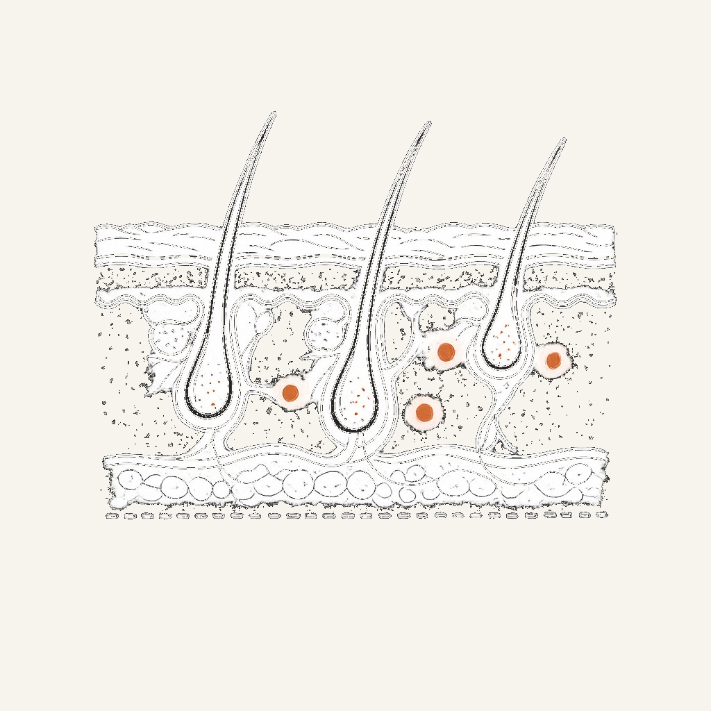 皮膚疾患のイラスト